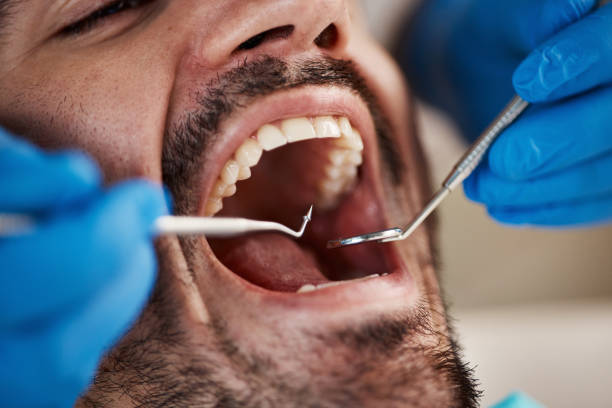 Best Knocked-Out Tooth Emergency  in Springfield, OH